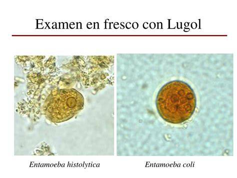 Preparación fecal teñida con Lugol
