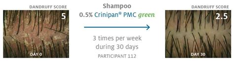 Esquema de acción del CRINIPAN PMC GREEN