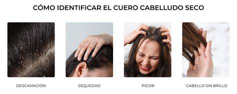 Contaminación acumulada en cabello y cuero cabelludo