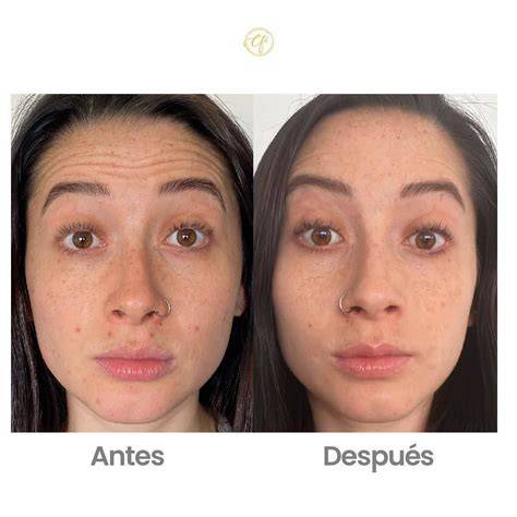 Antes y después de purificar un Pokémon oscuro