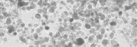 Nanopartículas de hierro encapsuladas en carbono