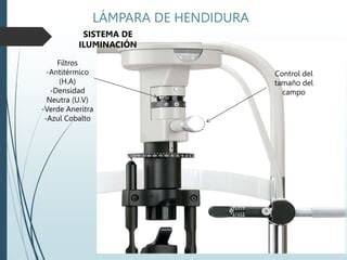 Filtros ópticos en lámpara de hendidura
