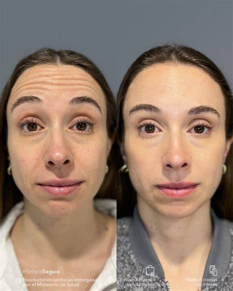 Retrato antes y después con ojos azules