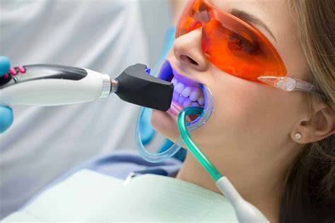 Filtro de blanqueamiento dental en selfie