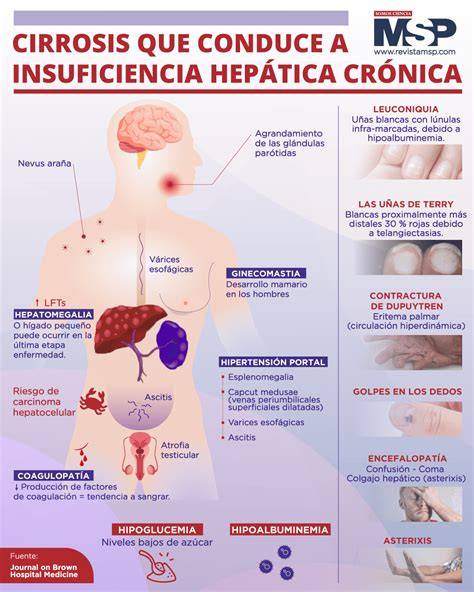 Causas principales de insuficiencia hepática crónica