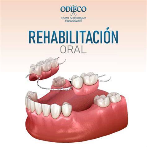 Bienestar oral y rehabilitación prostodóntica