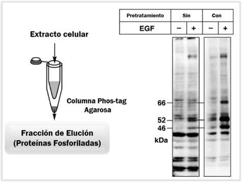 Separación Phos-tag de proteínas fosforiladas