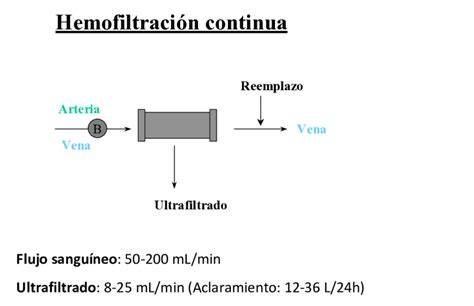 Esquema del circuito de hemofiltración continua