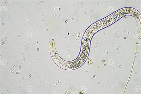Perfil de suelo con nematodos microscópicos