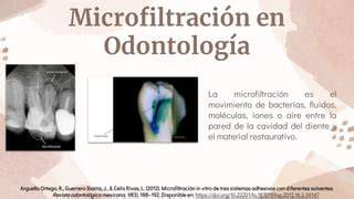 Microfiltración entre diente y restauración