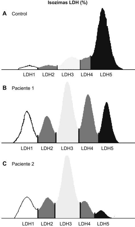 Distribución tisular de las cinco isoenzimas LDH