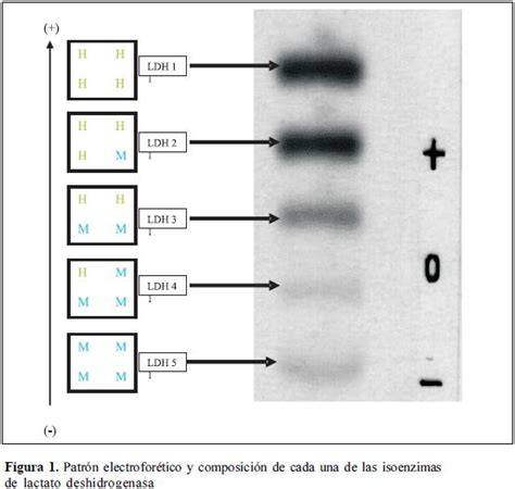 Electroforesis de isoenzimas de lactato deshidrogenasa