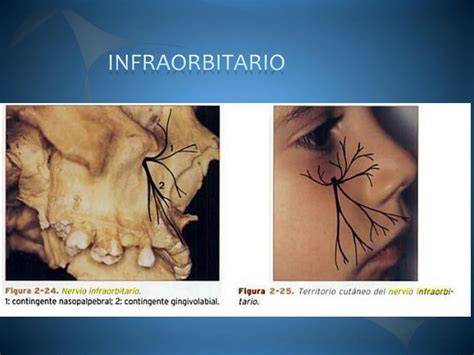 Seguimiento fotográfico del hematoma infraorbitario